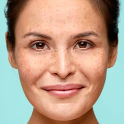 Biodermal Gelcrème Vette & Gemengde Huid 50 ml