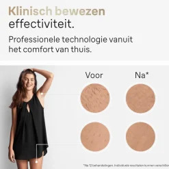 Braun IPL Silk-expert Pro 5