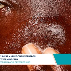 CeraVe Acne Cleanser 236 ml