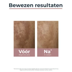 Eucerin Anti-Pigment Dagcrème SPF30 50 ml