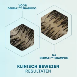 Head & Shoulders Anti-roos Shampoo DERMAxPRO Revitaliseert 250 ml