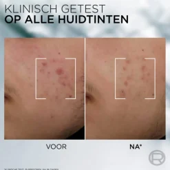 L'Oréal Men Expert Derma Control Serum 30 ml