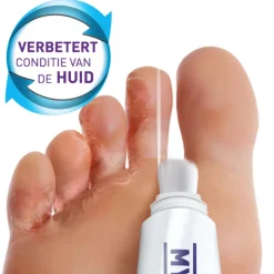 Mycosan Behandelset Gel Voetschimmel 15 ml