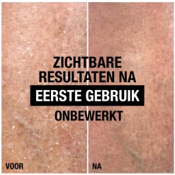 Neutrogena Intense Repair Cica Body Balm 250 ml