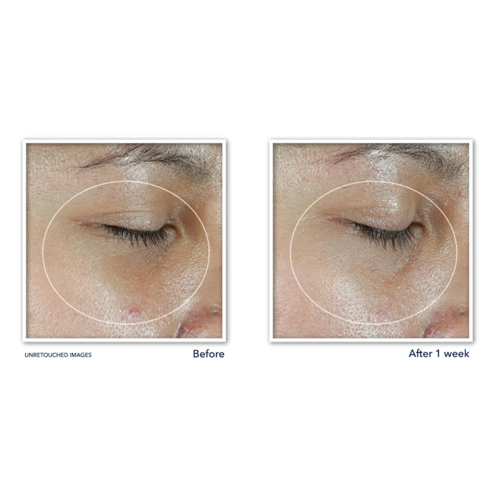 RoC Multi Correxion Revive + Glow Eye Stick 4 gr