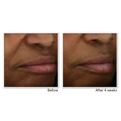 RoC Multi Correxion Revive + Glow Gel Crème 50 ml