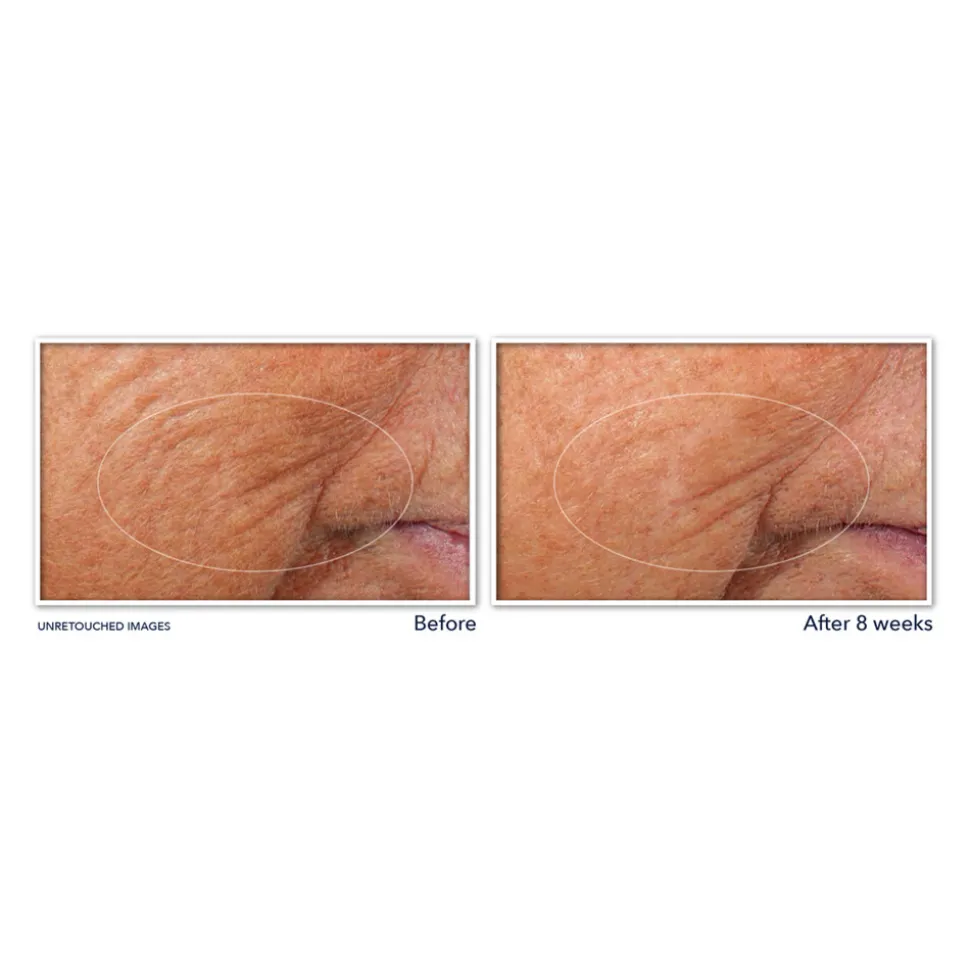 RoC Retinol Correxion Serum Nacht 30 stuks