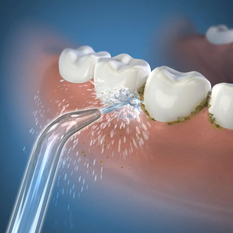 Waterpik Classic Jet Tips JT-100E 2022 2 stuks