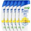 6x Head & Shoulders 2in1 Citrus Fresh 300 ml