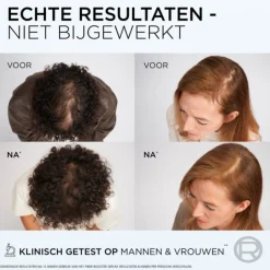 6x L'Oréal Elvive Fiber Booster Anti-Haaruitval Shampoo 200 ml