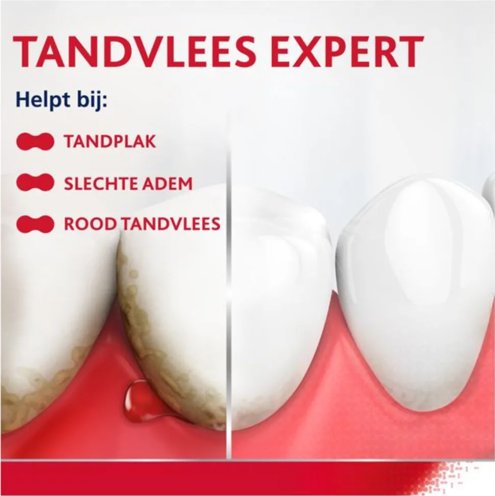 6x Parodontax Tandpasta bij Bloedend Tandvlees Whitening 2 x 75 ml