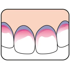 5x TePe PlaqSearch 10 tabletten